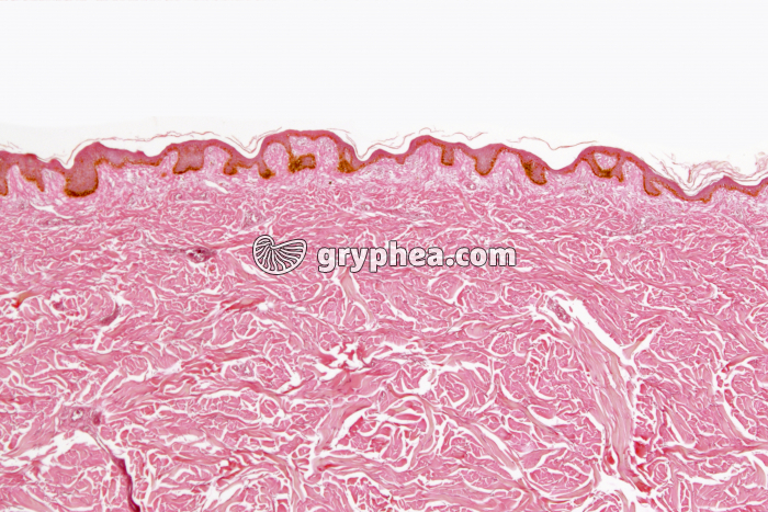 Peau pigmentée (race noire) x10 - gryphea.org